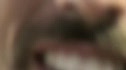 Ohio Stachie