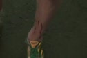 someones spiked leg
