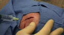 Head Stitch