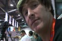 Joe has Zeb Miller syndrome