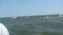 Aftermath of a Collision with a Jet Ski